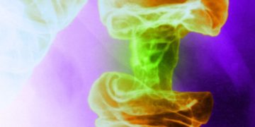 A New Light-Based Cancer Treatment Kills Tumor Cells and Spares Healthy Ones